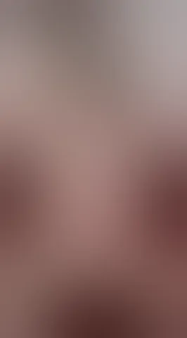 Red-haired dominance