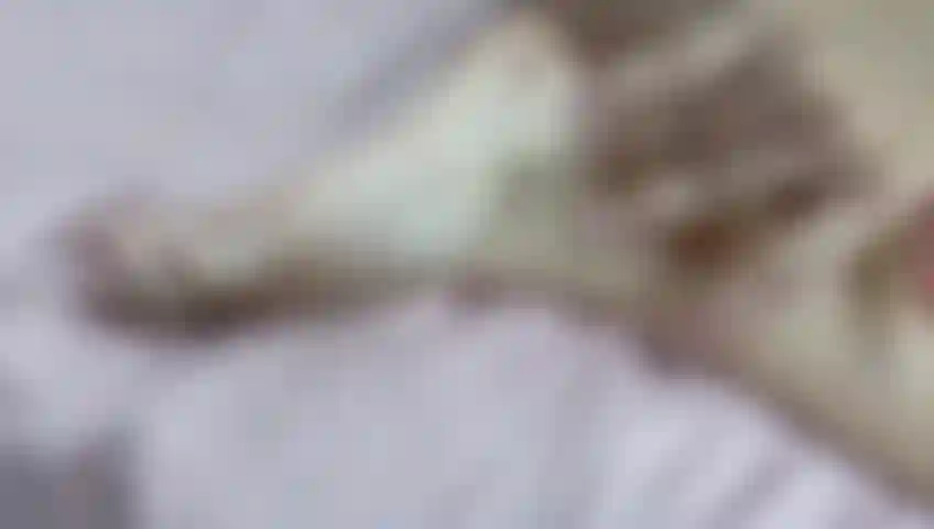 Évaluez le corps d'abby.