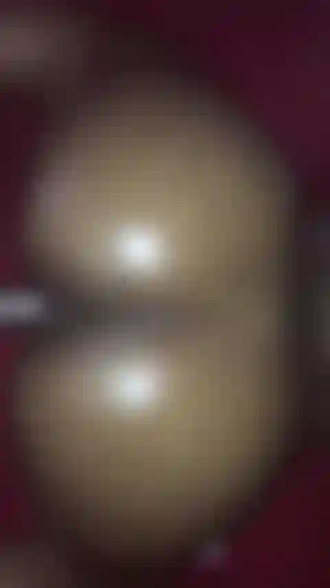 Coups de dos huilés.