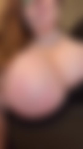 Gros seins veineux.
