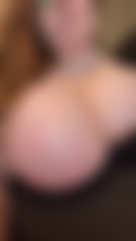 Gros seins veineux.