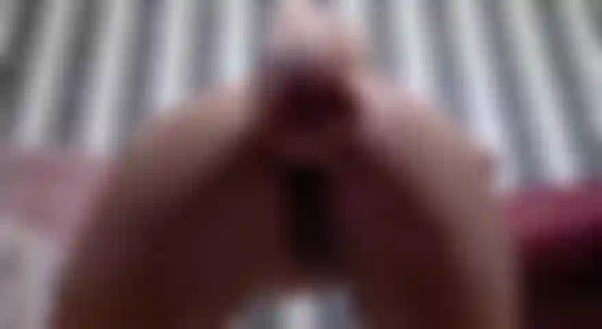 Analxxx