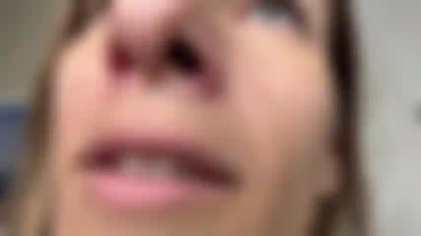 Nez fusées et fétichiste de la luette.